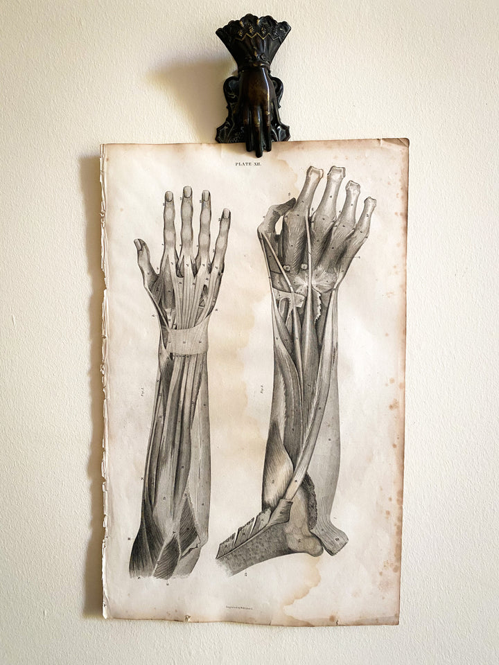 Lower Arm and Hand 1- Lizars 1824 'System of Anatomical Plates'