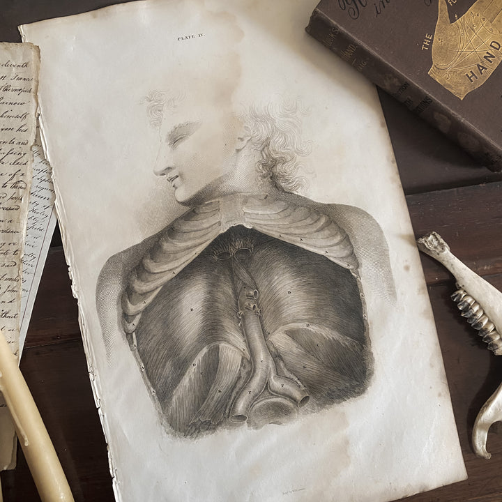 Male Torso- Lizars 1824 'System of Anatomical Plates'