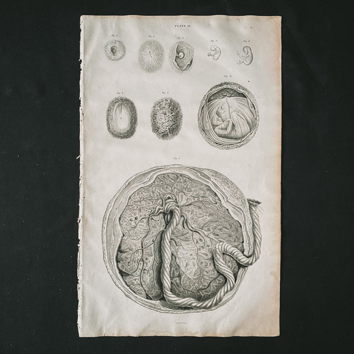 Embryo - Lizars 1824 'System of Anatomical Plates' - Houselore