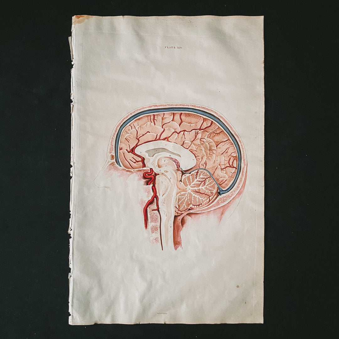 Head and Brain 2 - Lizars 1824 'System of Anatomical Plates' - Houselore