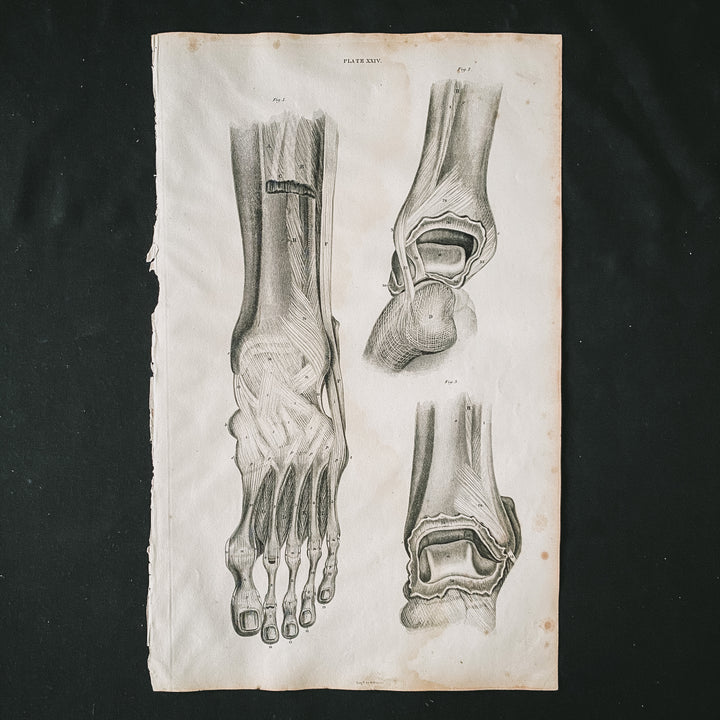 Der Fuß 1 - Lizars 1824 'System der anatomischen Platten'