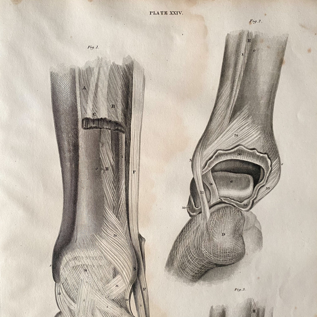 Der Fuß 1 - Lizars 1824 'System der anatomischen Platten'