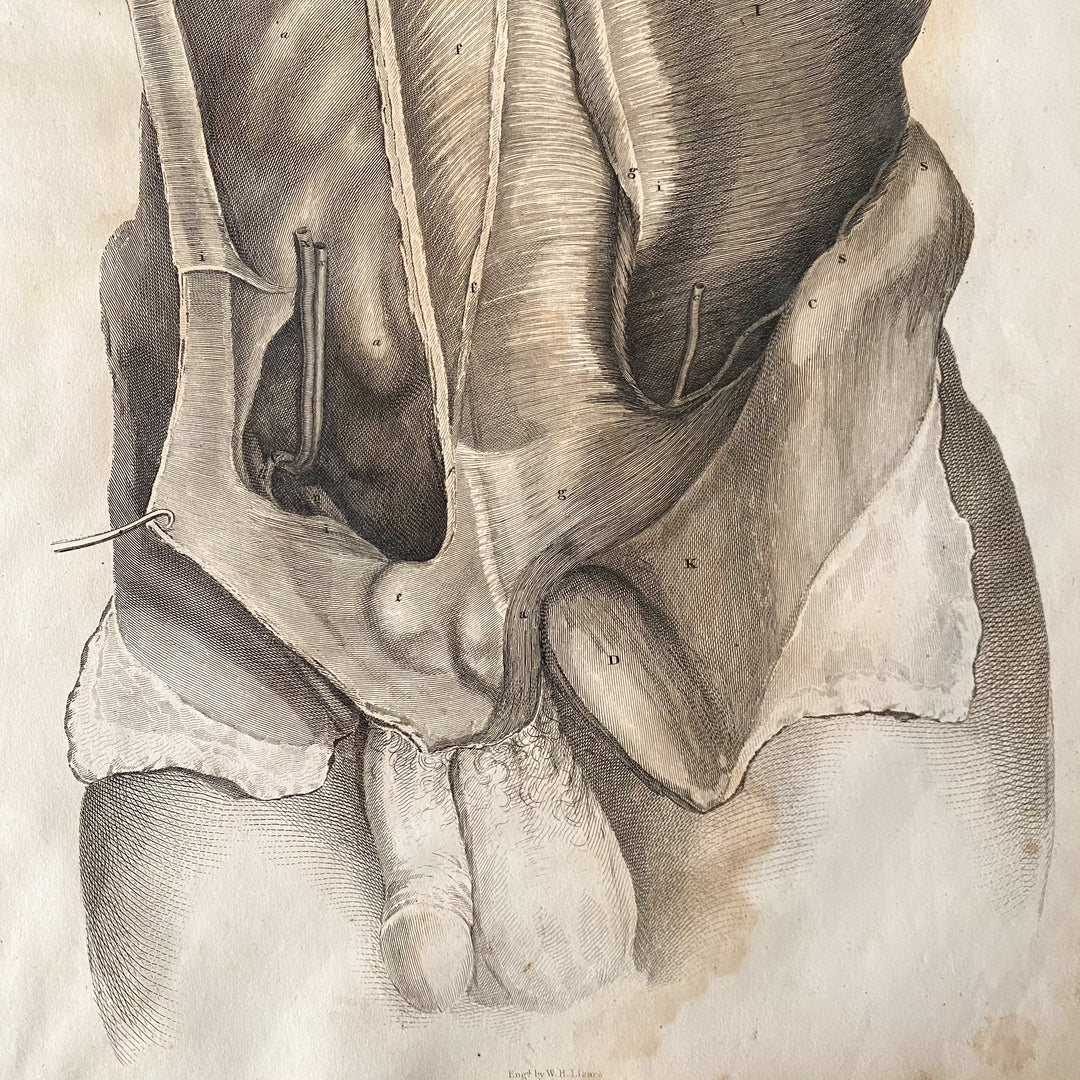 Male Lower Body 1 - Lizars 1824 'System of Anatomical Plates'