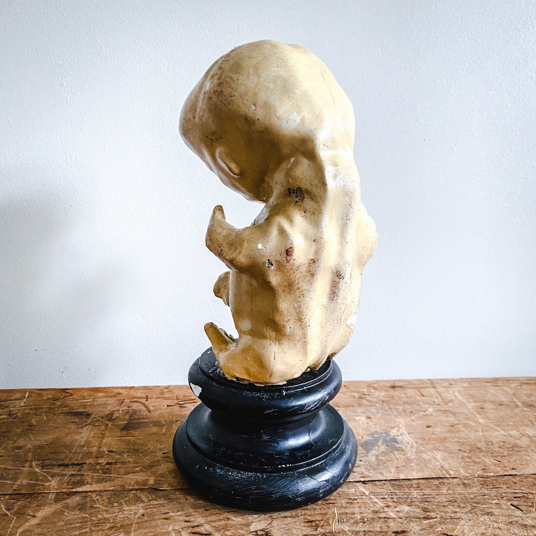 Model of a Fetus - Houselore