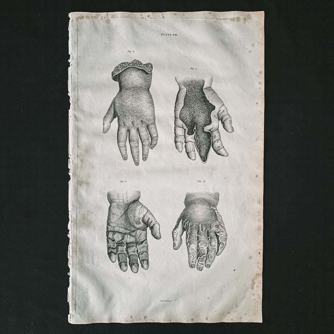 Small Hands - Lizars 1824 'System of Anatomical Plates' - Houselore