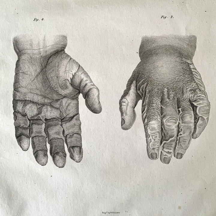 Small Hands - Lizars 1824 'System of Anatomical Plates' - Houselore