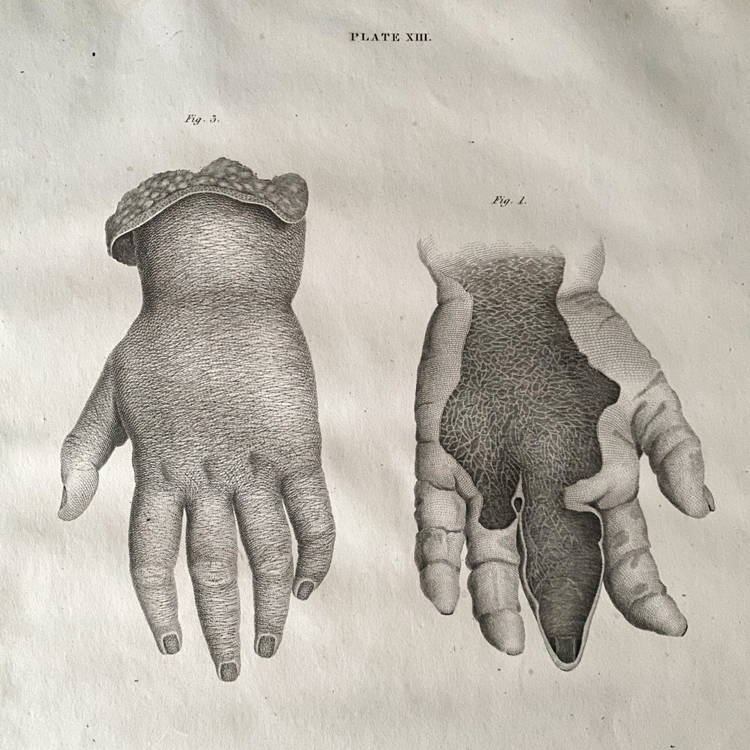 Small Hands - Lizars 1824 'System of Anatomical Plates' - Houselore