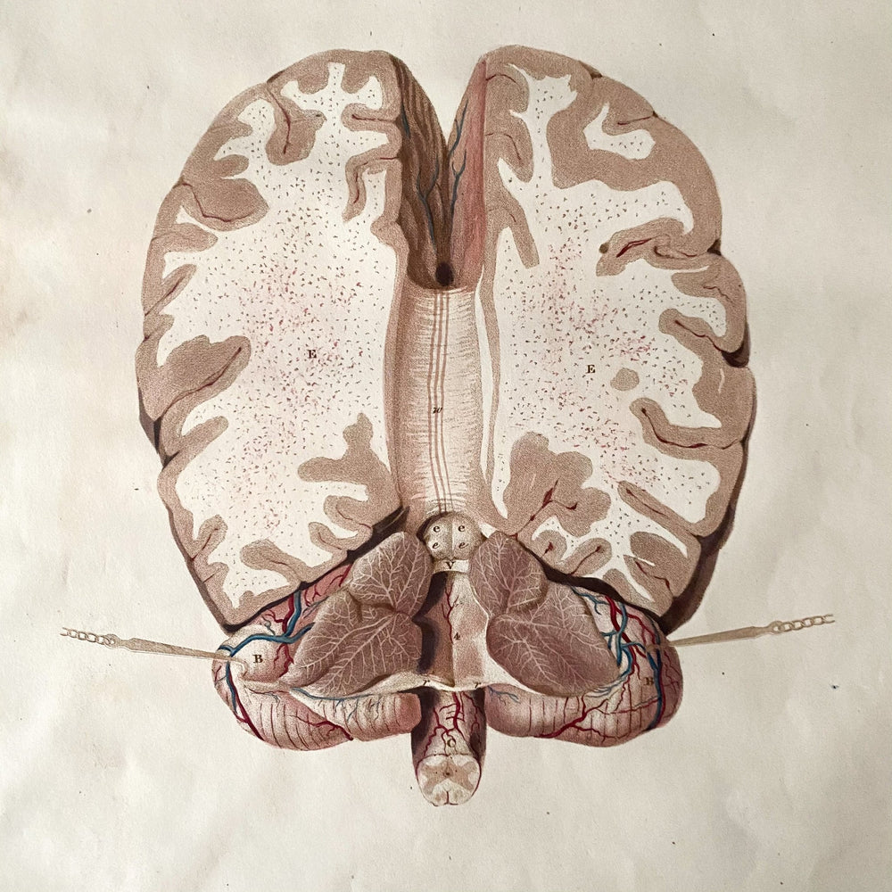 The Brain 3 - Lizars 1824 'System of Anatomical Plates' - Houselore