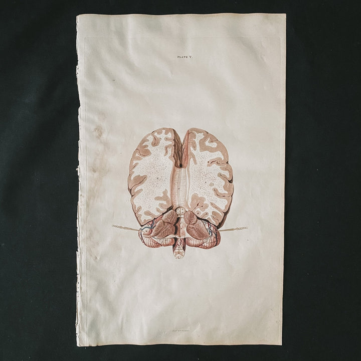 The Brain 3 - Lizars 1824 'System of Anatomical Plates' - Houselore