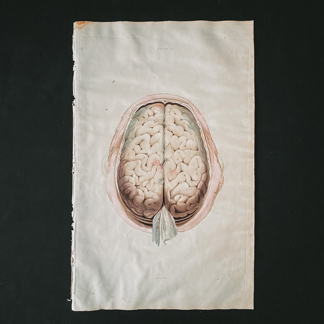 The Brain 8 - Lizars 1824 'System of Anatomical Plates' - Houselore